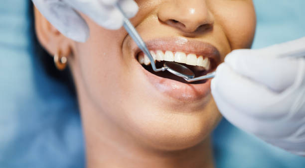 Best Emergency Wisdom Teeth Removal in Niceville, FL